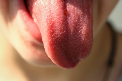 Ask A Therapist: Persons with DS have larger tongues?