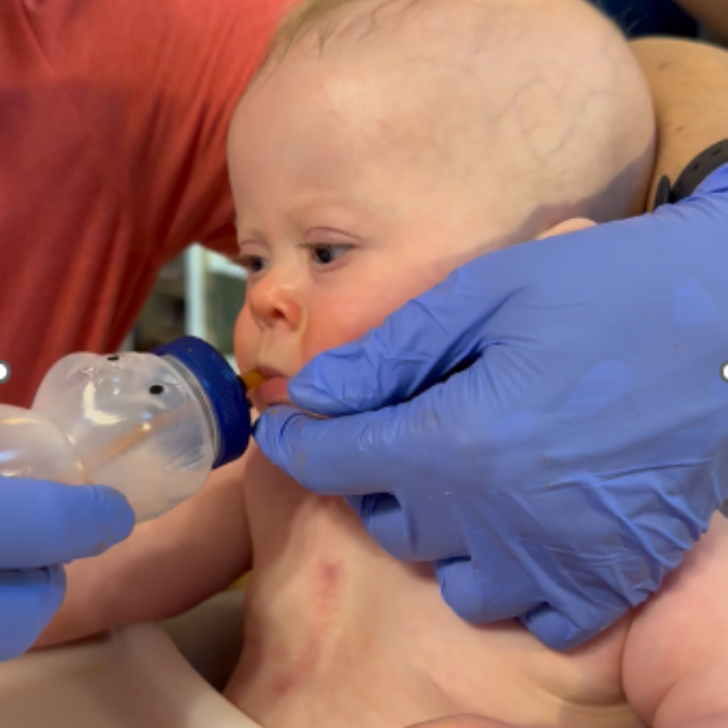 A Sensory Motor Approach to Adapted Baby Led Weaning